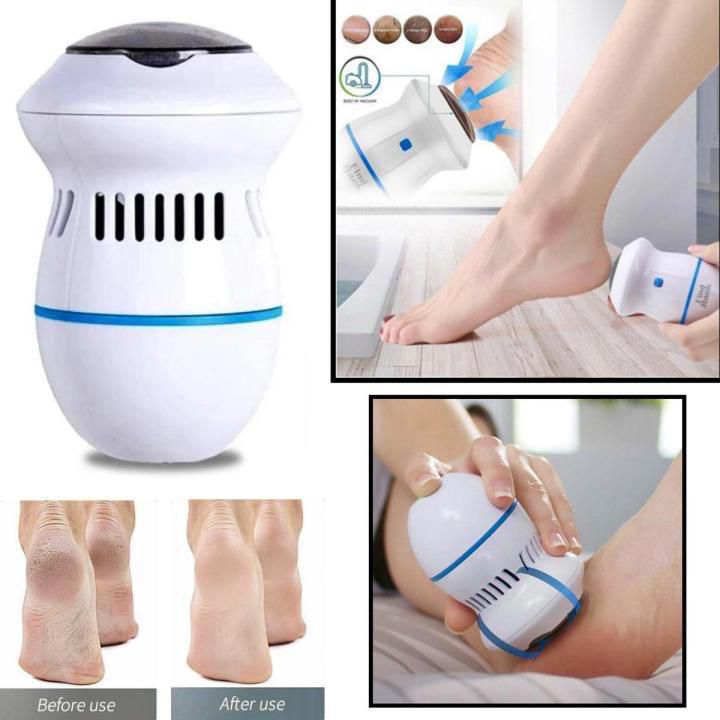 Electic Foot Cellus Remover Pedicure Tool